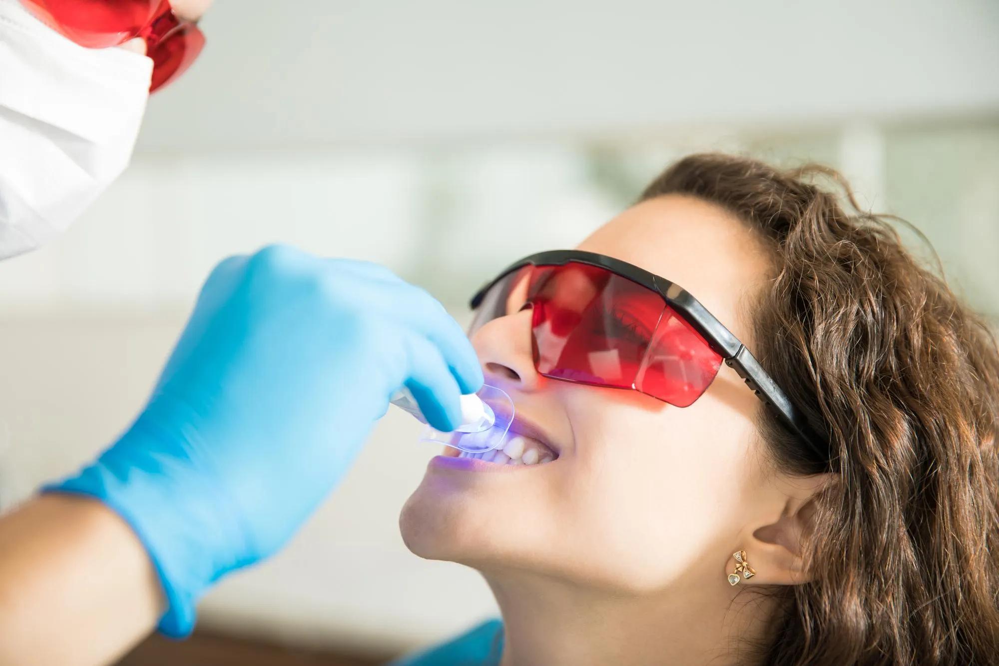 professional teeth whitening vs at home kits