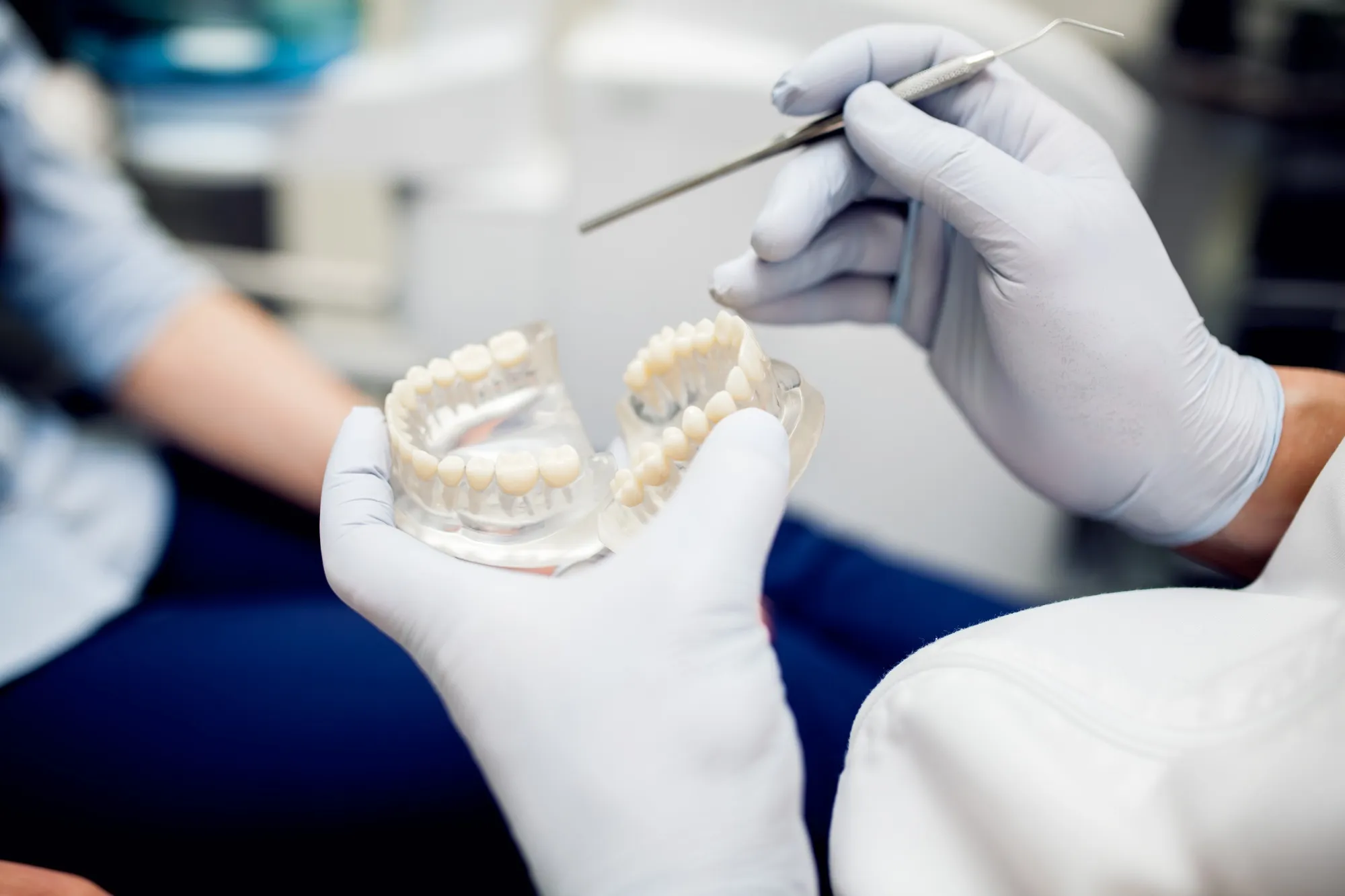 dental bridges for missing teeth