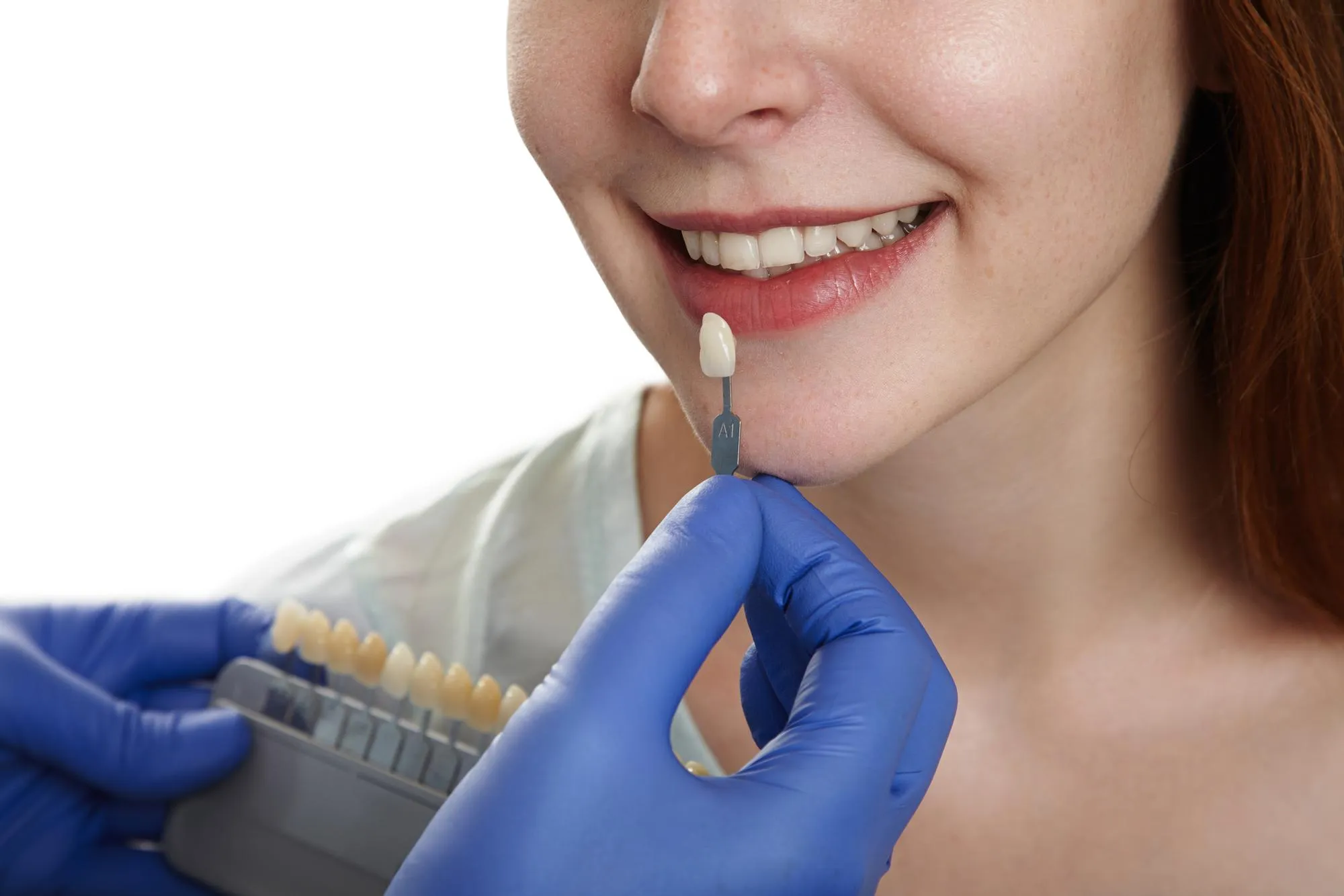 is dental bonding safe benefits risks